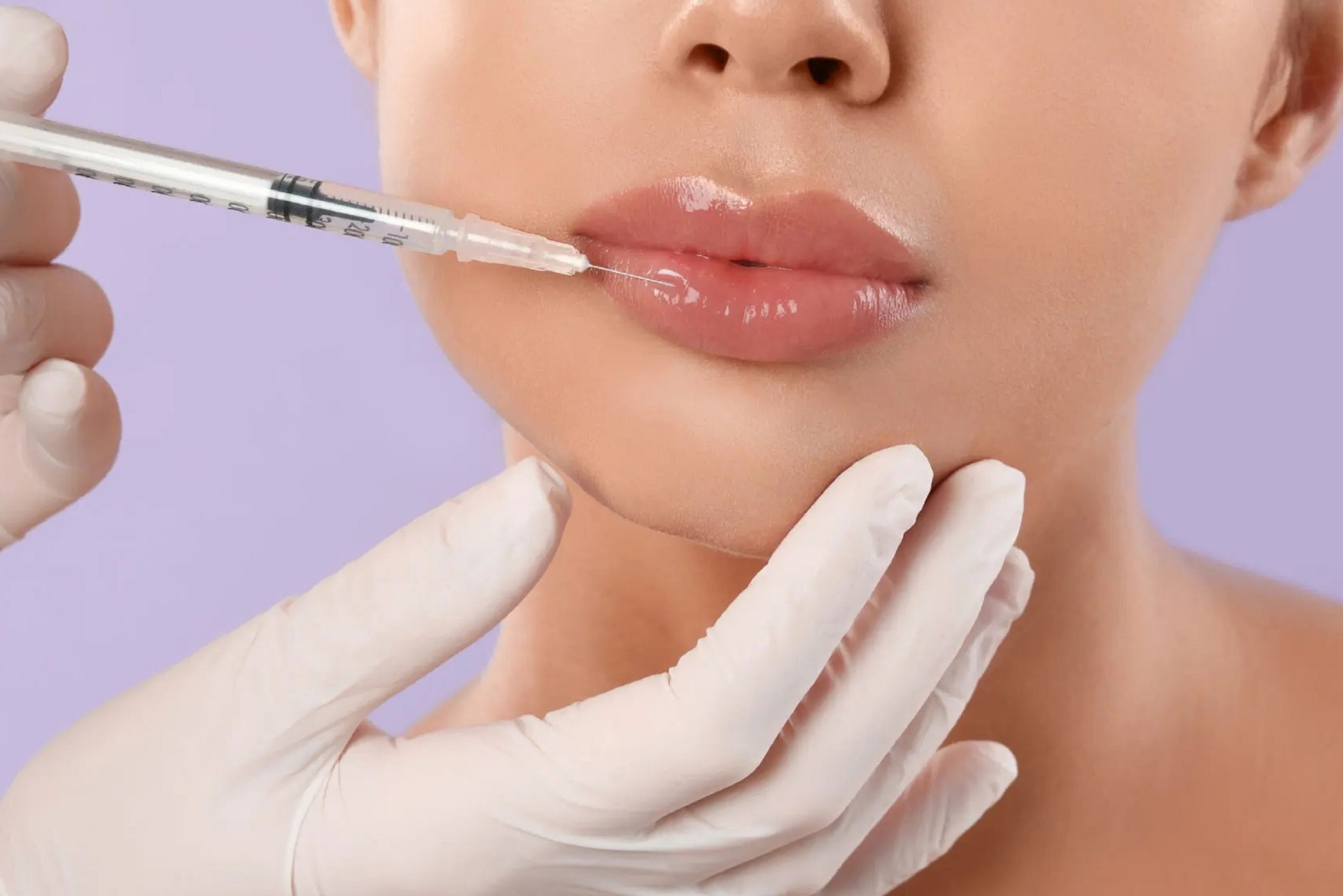 Dermal Filler